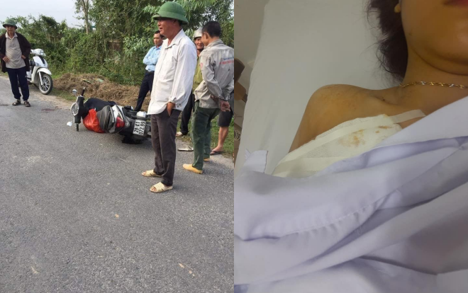 Xôn xao câu chuyện cô gái trẻ bị cướp đâm 2 nhát trọng thương trước ngày đi đăng ký kết hôn Ảnh 2