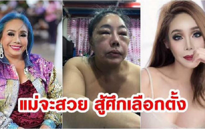 Choáng với nhan sắc hiện tại sau PTTM của nữ đại gia tuyển chồng 'phi công' đủ sức 'yêu' 28 lần/ngày Ảnh 2