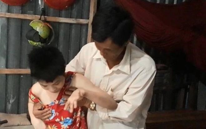 Cô gái bại não bị gã đàn ông đồi bại xâm hại, phải phá thai đến nỗi da bọc xương Ảnh 2