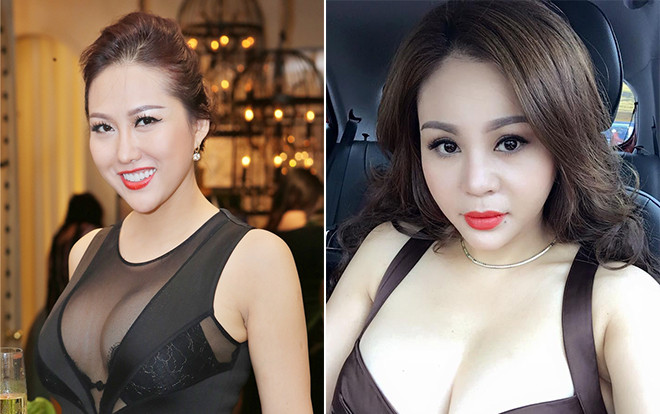 Cứ ngỡ Phi Thanh Vân phẫu thuật thẩm mỹ nhiều nhất, hóa ra 2 sao nữ này còn chẳng nhớ nổi số lần dao kéo Ảnh 2