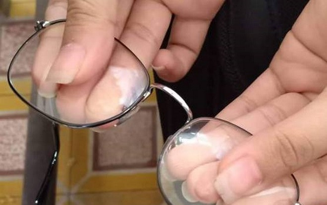 'Kết cực đắng' khi mạo hiểm cho hội bạn thân mượn kính: Khi đi lành lặn lúc về tan nát không thể nhận ra Ảnh 2