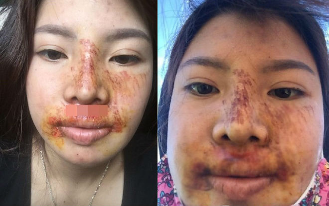 Bị đồn gương mặt biến dạng sau 2 năm PTTM, 'Thị Nở tái sinh' lên tiếng giải thích lí do khiến ai nấy đều ngã ngửa Ảnh 2