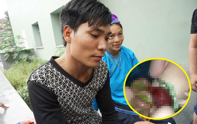 Tự đỡ đẻ cho vợ tại nhà vì không có tiền đi bệnh viện, người chồng bàng hoàng phát hiện cảnh tượng khó tin khi con gái chào đời Ảnh 2