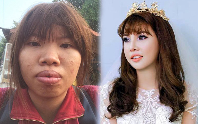 Ai cũng tưởng Phượng 'Thị Nở' là ca thẩm mỹ lột xác thành công nhất nhưng so với 2 người này chưa là gì Ảnh 2