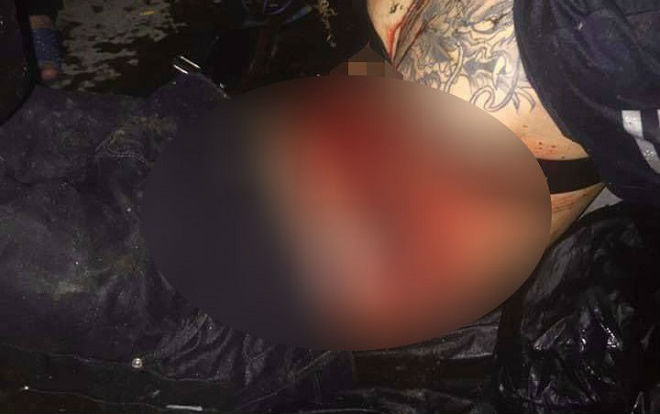 Ăn cắp tiền bị phát hiện, nam thanh niên nhảy xuống ao thoát thân thì bị vật nhọn đâm trọng thương Ảnh 2