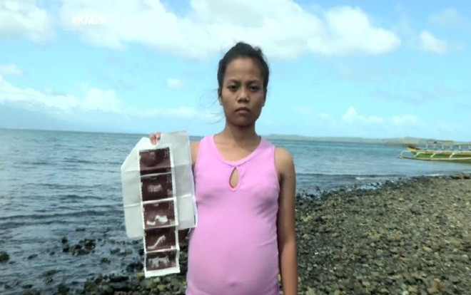 Thiếu nữ có bụng to bất thường khiến dân làng nghi mang thai với cá và sự thật 'ngã ngửa' Ảnh 2