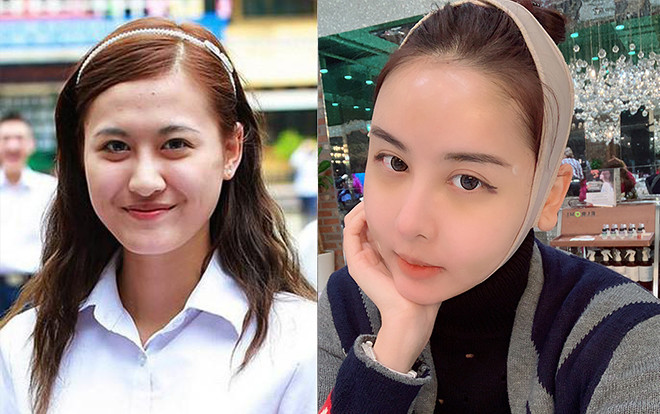 Choáng với diện mạo thay đổi 180 độ của Hà Lade sau khi chi 12.000 USD PTTM, đến mẹ cô còn phải thốt lên “Chả phải con mình”! Ảnh 2