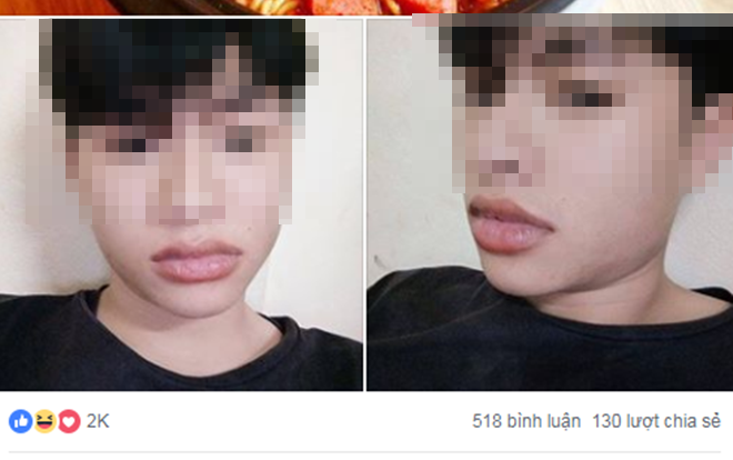 Hí hửng ăn mì cay cấp 7, chàng trai biến thành cá dọn bể với bờ môi thái vội 500 đĩa Ảnh 2