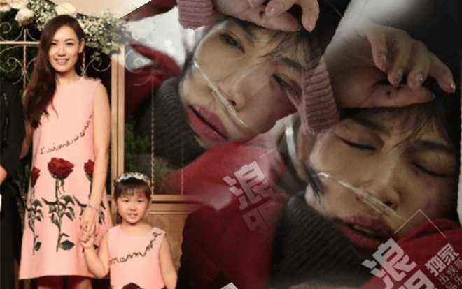 Sau khi chiếm đoạt bất thành tài sản của 'chồng cũ', Mã Dung lại tố Vương Bảo Cường bạo hành với thân thể đầy vết thương Ảnh 2