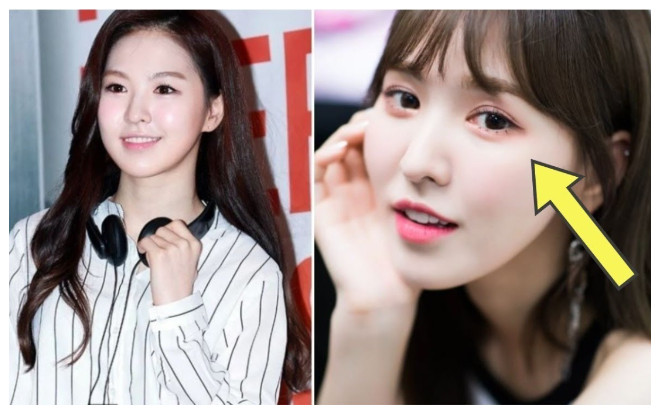Cư dân mạng tranh cãi nảy lửa vì nghi ngờ Wendy (RedVelvet) đã 'đụng chạm dao kéo' Ảnh 2