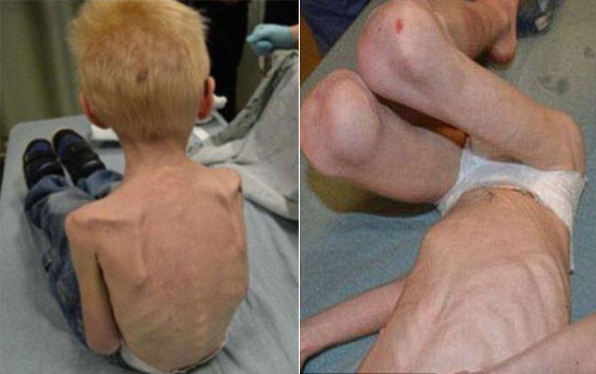 Cậu bé 5 tuổi bị mẹ kế nhốt trong phòng, bỏ đói đến gầy trơ xương Ảnh 2