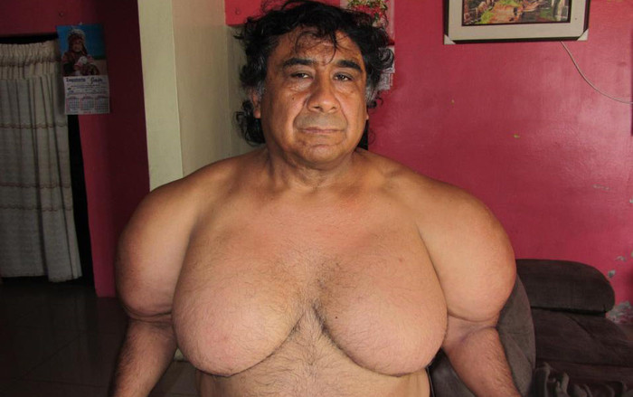 Người đàn ông mang hình dáng như thủy thủ Popeye và câu chuyện kinh hoàng phía sau Ảnh 2