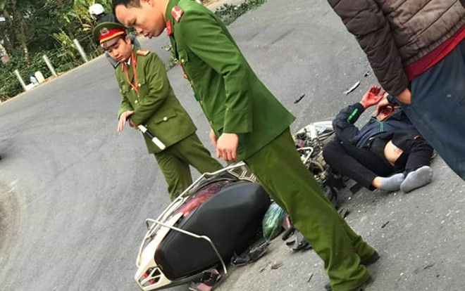 Xe máy mất phanh khi xuống dốc ở Tam Đảo, đôi nam nữ phượt thủ chấn thương nặng sau khi tông vào ô tô Ảnh 2