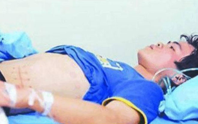 Bán thận để mua iPhone 4, chàng trai trả giá bằng nửa phần đời còn lại Ảnh 2