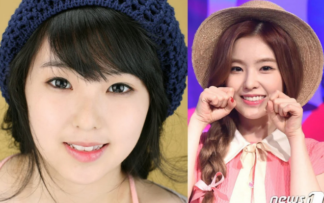 Điểm danh các ngôi sao xứ Hàn từng dính nghi án phẫu thuật thẩm mĩ Ảnh 2