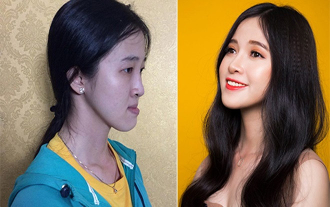 Cô gái 'móm' có thu nhập gấp đôi sau khi sửa mặt xinh đẹp Ảnh 2