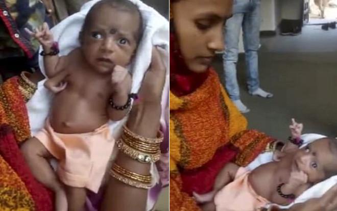 Bé gái Ấn Độ chào đời với 3 bàn tay được người dân tôn thờ như một vị thần Ảnh 2