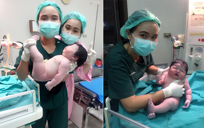 Em bé sơ sinh đẻ thường nặng 5,2kg bụ bẫm, đôi má phúng phính khiến dân mạng dậy sóng Ảnh 2