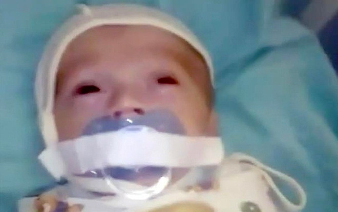 Bé sơ sinh 12 tuần tuổi bị dán băng dính quanh miệng khiến dân mạng bức xúc Ảnh 2