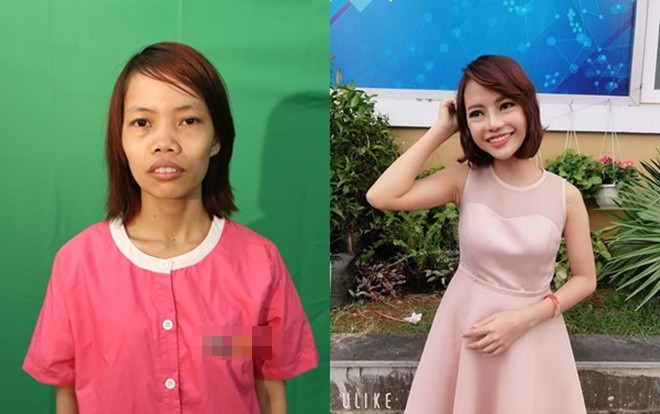 Tuyên bố gây sốc của mẹ đơn thân từng bị miệt thị vì 'xấu xúc phạm người nhìn' Ảnh 2