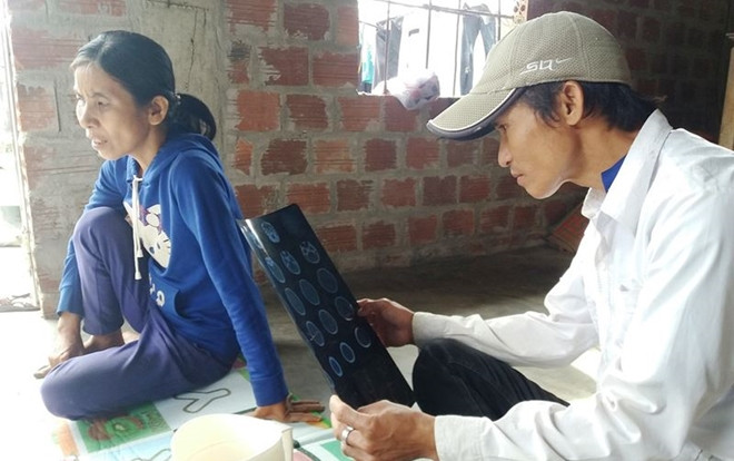 Học sinh lớp 1 bị cô giáo đánh đến chấn động sọ não chỉ vì chép nhầm bài kiểm tra? Ảnh 2