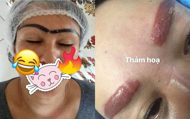 Đua nhau đi làm đẹp đón tết, hội chị em nhận được cái kết không thể 'thảm thương' hơn Ảnh 2