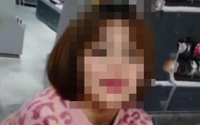 Đi phẫu thuật sửa mũi, cô gái trẻ phải trả giá bằng cả mạng sống Ảnh 2