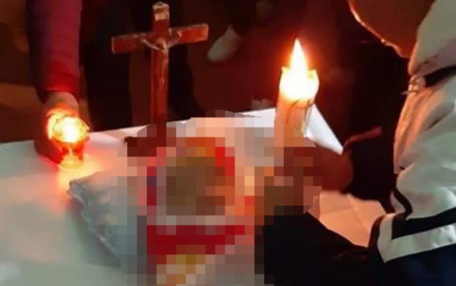 Bé gái 2,5 tháng tuổi tử vong sau 1 ngày tiêm vắc xin Ảnh 2