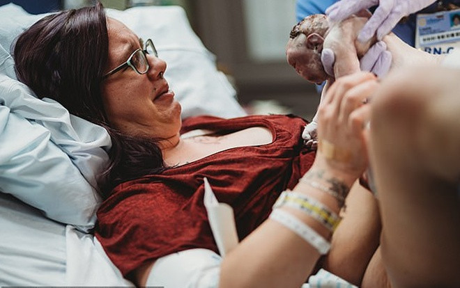 Sản phụ quyết định giữ thai nhi dị tật vì lý do vô cùng cảm động Ảnh 2