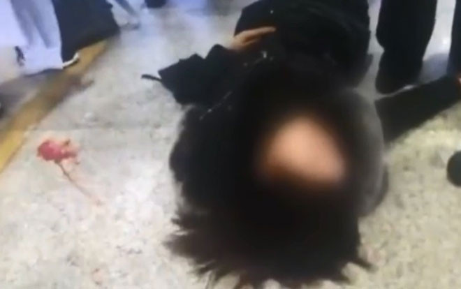 Thấy cô gái nằm sõng soài trên đất, máu mồm chảy be bét ai cũng hoảng sợ nhưng khi biết nguyên nhân mọi người chỉ đành câm nín Ảnh 2