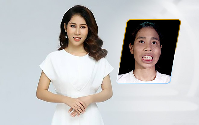 'Khỉ đột ăn đu đủ không cần thìa' lột xác thành cô gái xinh đẹp: Nhiều lần muốn tự tử nhưng nghĩ đến mẹ già tâm thần lại thôi Ảnh 2