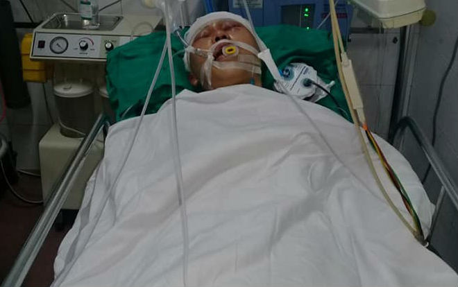 Nam sinh 17 tuổi bị nhóm đối tượng đánh chấn thương sọ não, hôn mê bất tỉnh Ảnh 2