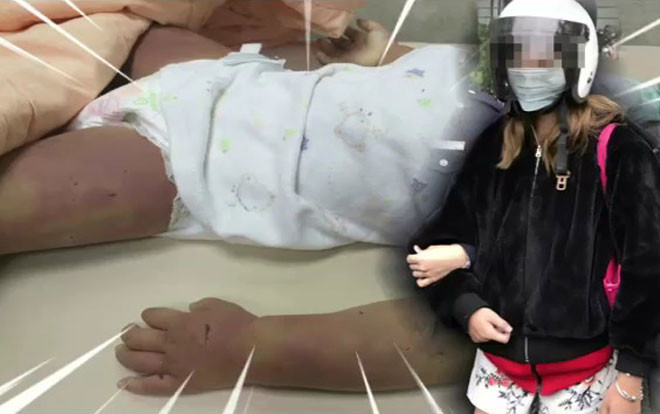 Mẹ 17 tuổi bạo hành con gái 1 tuổi rưỡi đến chết, nhìn vết tích trên người ai cũng căm phẫn Ảnh 2