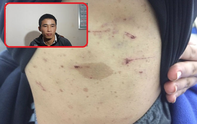 Thêm 1 vụ tra tấn dã man như thời trung cổ: Ông trùm chuyên 'điều đào' dùng kéo hành hạ nhân viên suốt 2 ngày trời Ảnh 2