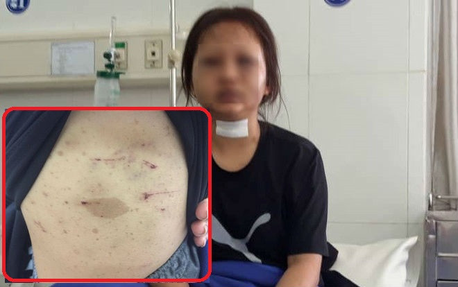 Vụ ông trùm chuyên 'điều đào' dùng kéo hành hạ nhân viên suốt 2 ngày trời: Không 'chiều' khách là bị đánh đến ngất xỉu Ảnh 2