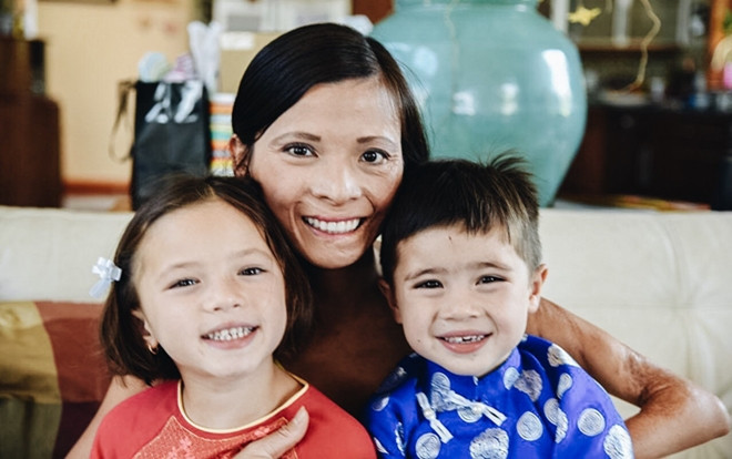 Em bé sơ sinh bị rơi vào chậu than hồng và nghị lực của cô gái 10 lần phẫu thuật khiến nhiều người nể phục Ảnh 2