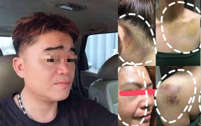 Chồng đánh vợ tới biến dạng, bạo hành con cái khiến dân tình phải thốt lên: 'Đồ rác rưởi' Ảnh 2