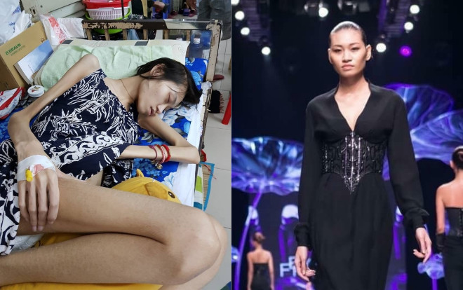 Người mẫu Việt từng được H'Hen Niê kêu gọi giúp đỡ đã qua đời Ảnh 2