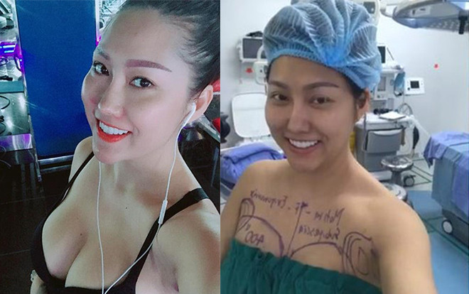 Nóng bỏng và xinh đẹp, ai mà biết được Phi Thanh Vân đã phải trải qua những ca đại tu tiền tỉ Ảnh 2