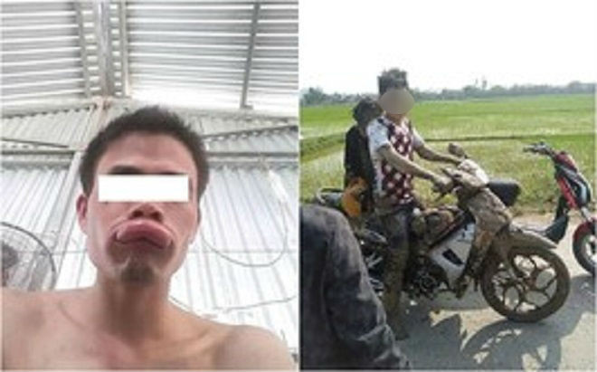 Nhọ nhem đầu năm mới: Người bị ong đốt sưng vều môi, người phi xuống ruộng toàn thân đầy bùn ngay ngày Tết Ảnh 2