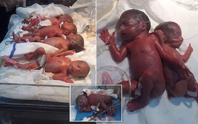 Người phụ nữ 25 tuổi sinh thường 7 đứa con cùng một lúc Ảnh 2