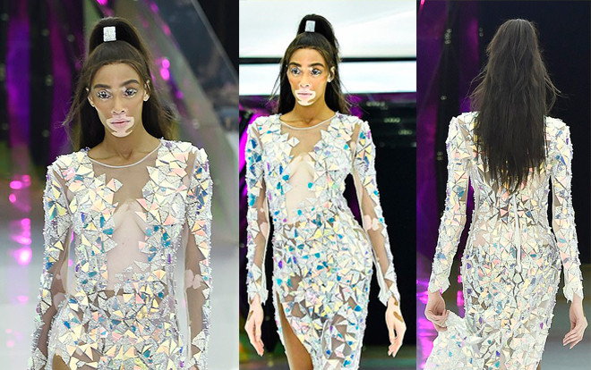 Thiên thần bạch biến Winnie Harlow mặc váy xuyên thấu soi rọi cơ thể tại Milan Fashion Week 2019 Ảnh 2