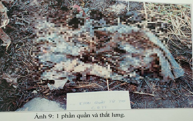 Xác định danh tính và tìm thân nhân của bộ xương được phát hiện ở Bình Dương Ảnh 2