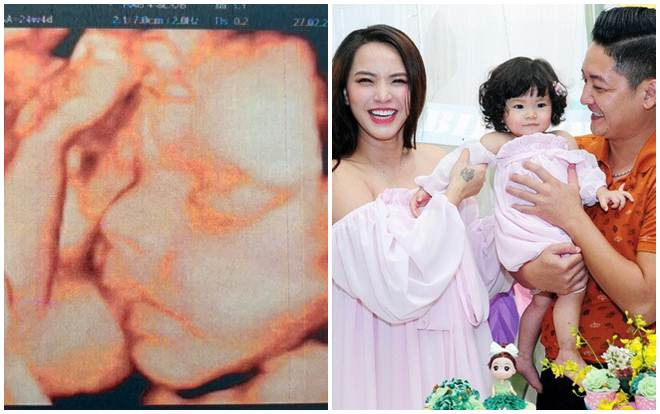 Hải Băng khoe ảnh siêu âm con thứ ba, tiết lộ chính thức ngày chào đời Ảnh 2