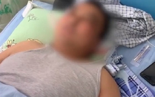 Cãi nhau với vợ, ông chồng làm điều kinh khủng này trên người mình để 'xả tức' Ảnh 2