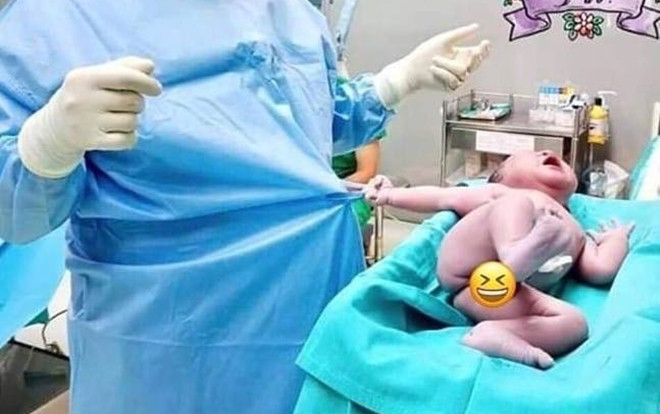Bé con vừa chào đời đã giật áo bác sĩ đầy hờn dỗi: ‘Ơ sao lại đưa người ta ra thế này’ khiến dân mạng phì cười Ảnh 2