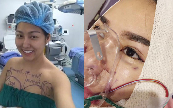 Những sao Việt khoe ảnh dao kéo ám ảnh khiến fan hoảng hốt Ảnh 2