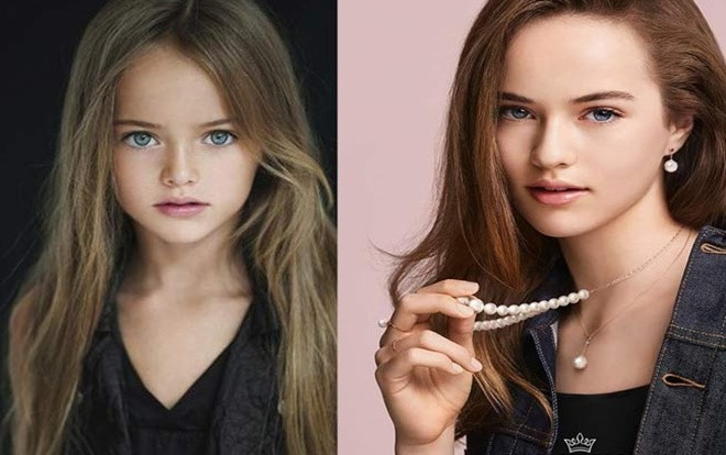 Ngỡ ngàng trước nhan sắc hiện tại của 'bé gái đẹp nhất thế giới' Ảnh 2