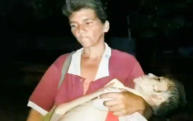 Ám ảnh cảnh cô gái 19 tuổi suy dinh dưỡng chết trong vòng tay mẹ giữa cơn tuyệt vọng vì mất điện diện rộng ở Venezuela Ảnh 2