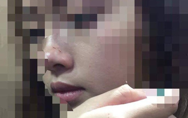 Vụ cô gái bị cưỡng hôn trong thang máy chung cư cao cấp: Sẽ công khai xin lỗi tại tòa nhà Ảnh 2